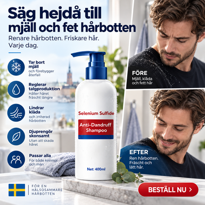 🧴 50% RABATT NU! ✨ Selensulfid Anti-mjäll- och oljekontrollschampo – bekämpar mjäll, lindrar klåda & balanserar talg – för en ren och fräsch hårbotten 💚