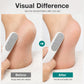 🧼 50% RABATT NU! ✨ Dubbelsidig fotfil för borttagning av förhårdnader – rostfritt stål, djuprengöring av tåsömmar & hållbar – perfekt för fotspa hemma 🦶💅